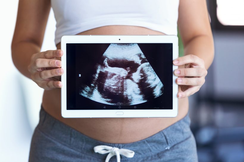 Ultrahangos kép kisbabáról